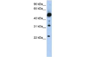 Western Blotting (WB) image for anti-Transmembrane Protein 38B (TMEM38B) antibody (ABIN2459106) (TMEM38B Antikörper)