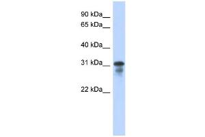 WB Suggested Anti-MED6 Antibody Titration:  0. (MED6 Antikörper  (Middle Region))