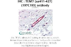 Image no. 1 for anti-Plexin Domain Containing 1 (PLXDC1) (AA 411-427) antibody (ABIN5693726) (PLXDC1 Antikörper  (AA 411-427))