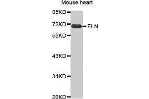 Western blot analysis of extracts of various cell lines, using ELN antibody. (Elastin Antikörper  (AA 27-200))