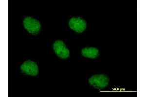 Immunofluorescence of purified MaxPab antibody to MCM10 on HeLa cell. (MCM10 Antikörper  (AA 1-874))