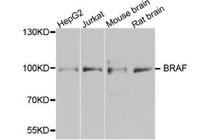 Western blot analysis of extracts of various cell lines, using BRAF antibody. (BRAF Antikörper  (AA 280-460))