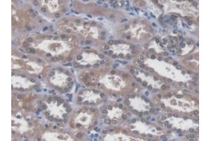 Detection of SNAI1 in Human Kidney Tissue using Polyclonal Antibody to Snail Homolog 1 (SNAI1) (SNAIL Antikörper  (AA 1-264))