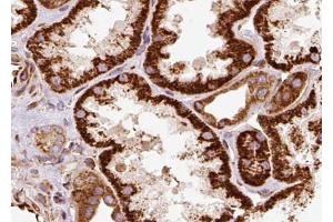 ABIN6268779 at 1/100 staining human kidney tissue sections by IHC-P. (Aquaporin 1 Antikörper  (Internal Region))
