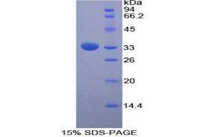 SDS-PAGE analysis of Rat FUCa1 Protein.