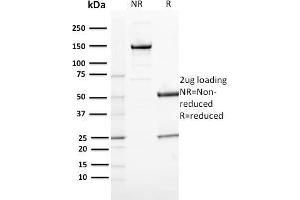 SDS-PAGE Analysis Purified CD163 Mouse Monoclonal Antibody (M130/2164). (CD163 Antikörper  (AA 43-196))