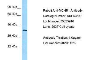Western Blotting (WB) image for anti-Melanin-Concentrating Hormone Receptor 1 (MCHR1) (N-Term) antibody (ABIN971125) (MCHR1 Antikörper  (N-Term))