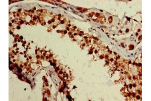 Immunohistochemistry of paraffin-embedded human testis tissue using ABIN7176240 at dilution of 1:100 (ZNF331 Antikörper  (AA 179-442))