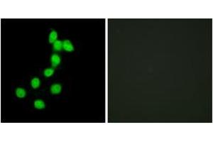 Immunofluorescence analysis of HepG2 cells, using DYR1A Antibody. (DYRK1A Antikörper  (AA 21-70))