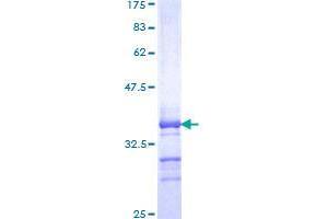 Image no. 1 for Basic Leucine Zipper Transcriptional Factor ATF-Like 3 (BATF3) (AA 48-125) protein (GST tag) (ABIN1346444)