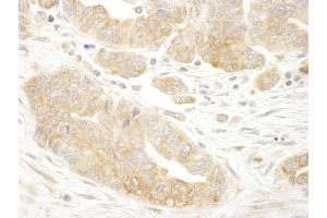 anti-Eukaryotic Translation Initiation Factor 3, Subunit B (EIF3B) (AA 100-150) antibody