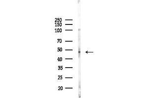 anti-Carboxypeptidase Q (CPQ) antibody