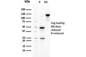 SDS-PAGE Analysis Purified Heregulin-1 Mouse Monoclonal Antibody (NRG1/2710). (Neuregulin 1 Antikörper  (AA 21-242))