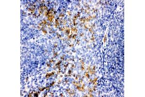 IHC analysis of MCP1/CCL2 using anti-MCP1/CCL2 antibody (ABIN3042598). (CCL2 Antikörper  (AA 24-99))