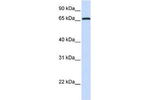 WB Suggested Anti-MED26 Antibody Titration:  0.