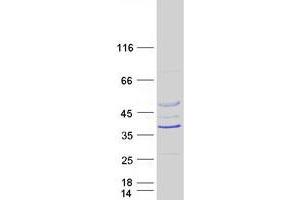 Validation with Western Blot (RTDR1 Protein (Myc-DYKDDDDK Tag))