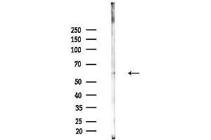 Western blot analysis of lysates from MCF7 cells(heat-shock,45 min treatment), using Phospho-Estrogen Receptor-beta (Ser105) Antibody at 1/1000 dilution.