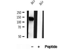Western blot analysis of extracts of HeLa cells, using NBR1 antibody. (NBR1 Antikörper)