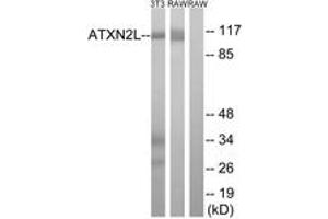 Western blot analysis of extracts from NIH-3T3/RAW264. (Ataxin 2-Like Antikörper  (AA 571-620))
