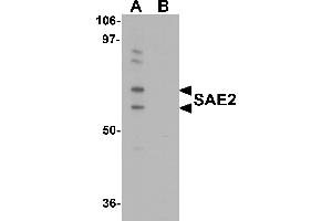 Western Blotting (WB) image for anti-SUMO1 Activating Enzyme Subunit 2 (UBA2) (C-Term) antibody (ABIN1030636) (UBA2 Antikörper  (C-Term))