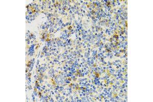 Immunohistochemistry of paraffin-embedded mouse spleen using SH2B1 Antibody. (SH2B1 Antikörper)