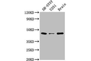 Western Blot Positive WB detected in: SH-SY5Y whole cell lysate, U251 whole cell lysate, Rat brain tissue All lanes: LRTM2 antibody at 1:2000 Secondary Goat polyclonal to rabbit IgG at 1/50000 dilution Predicted band size: 42 kDa Observed band size: 42 kDa (LRTM2 Antikörper  (AA 36-310))