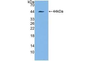 Detection of Recombinant KRT7, Human using Polyclonal Antibody to Cytokeratin 7 (CK7) (Cytokeratin 7 Antikörper  (AA 91-394))