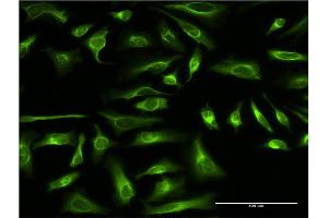 Immunofluorescence of monoclonal antibody to PRC1 on HeLa cell. (PRC1 Antikörper  (AA 1-620))