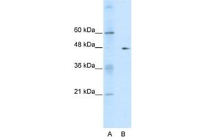 WB Suggested Anti-GDI2  Antibody Titration: 0. (GDI2 Antikörper  (C-Term))