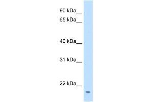 FAM107A antibody used at 0. (FAM107A Antikörper  (Middle Region))