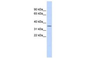 Image no. 1 for anti-Ficolin (Collagen/fibrinogen Domain Containing) 1 (FCN1) (AA 180-229) antibody (ABIN6743782) (FCN1 Antikörper  (AA 180-229))