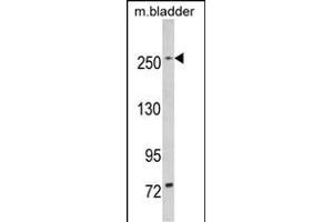Western blot analysis of LRRK1 (ABIN391141 and ABIN2837943) in mouse bladder tissue lysates (35 μg/lane). (LRRK1 Antikörper  (C-Term))