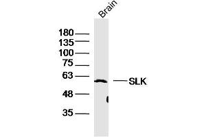 Mouse Brain lysates probed with SLK Polyclonal Antibody, Unconjugated  at 1:300 dilution and 4˚C overnight incubation.
