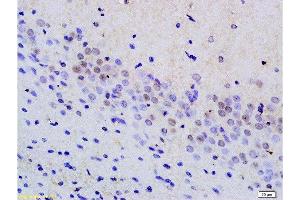 Formalin-fixed and paraffin embedded rat brain tissue labeled with Anti phospho-MAP3K9+MAP3K10(Thr312+Thr266) Polyclonal Antibody, Unconjugated  at 1:200 followed by conjugation to the secondary antibody and DAB staining (MAP3K9 Antikörper  (pThr312))