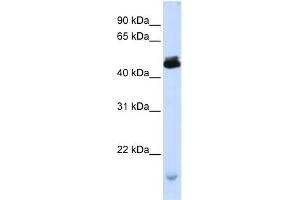 WB Suggested Anti-KCMF1 Antibody Titration:  0. (KCMF1 Antikörper  (C-Term))