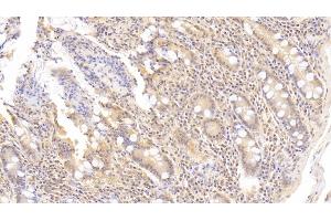 Detection of AXIN in Human Small intestine Tissue using Polyclonal Antibody to Axis Inhibition Protein (AXIN) (Axin Antikörper  (AA 653-862))