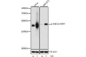 Western blot analysis of extracts of various cell lines using Phospho-SMC1A(S957) Polyclonal Antibody at dilution of 1:1000. (SMC1A Antikörper  (pSer957))