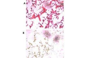 (A) H&E staining of frozen human ovarian cancer tissue with UCH37 antibody at 1:250. (UCHL5 Antikörper  (AA 56-87))
