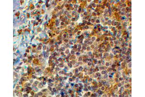 Immunohistochemistry (IHC) image for anti-EF-Hand Domain Family, Member D2 (EFHD2) (C-Term) antibody (ABIN185311)