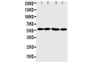 Anti-ANGPTL1 antibody, Western blotting Lane 1: A549 Cell Lysate Lane 2: SW620 Cell Lysate Lane 3: MCF-7 Cell Lysate Lane 4: MM231 Cell Lysate (ANGPTL1 Antikörper  (C-Term))