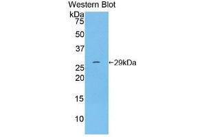 Western Blotting (WB) image for anti-Integrin alpha D (ITGAD) (AA 879-1099) antibody (ABIN3208930) (ITGAD Antikörper  (AA 879-1099))