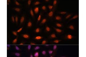 Immunofluorescence analysis of U-2 OS cells using PPIL4 Polyclonal Antibody at dilution of 1:100. (PPIL4 Antikörper)