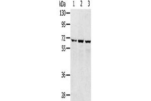Gel: 8 % SDS-PAGE, Lysate: 40 μg, Lane 1-3: 293T cells, hepg2 cells, A172 cells, Primary antibody: ABIN7192509(SLC5A9 Antibody) at dilution 1/300, Secondary antibody: Goat anti rabbit IgG at 1/8000 dilution, Exposure time: 1 minute (SLC5A9 Antikörper)