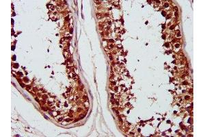 Immunohistochemistry (IHC) image for anti-Proteasome (Prosome, Macropain) 26S Subunit, ATPase, 6 (PSMC6) (AA 1-260), (Regulatory Subunit 10B) antibody (ABIN7142226)