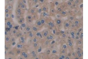 Detection of CNX in Mouse Liver Tissue using Polyclonal Antibody to Calnexin (CNX)