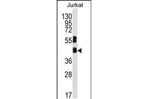 Western blot analysis in Jurkat cell line lysates (35ug/lane). (MAFB Antikörper  (C-Term))