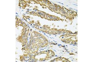 Immunohistochemistry of paraffin-embedded human prostate using HLA-DQA1 antibody. (HLA-DQA1 Antikörper  (AA 24-216))