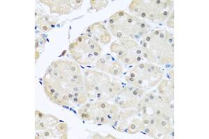 Immunohistochemistry of paraffin-embedded human stomach using DNAL1 antibody at dilution of 1:100 (x40 lens).