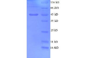SDS-PAGE (SDS) image for Golgi Membrane Protein 1 (GOLM1) (AA 36-401), (partial) protein (His tag) (ABIN1095615)