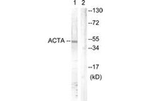Western blot analysis of extracts from mouse brain cells, using Actin-pan ( alpha/gamma)  (Ab-55/53) Antibody. (Actin Antikörper  (AA 21-70))